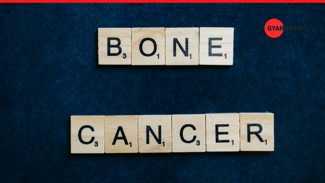The Ultimate Guide to Bone Cancer